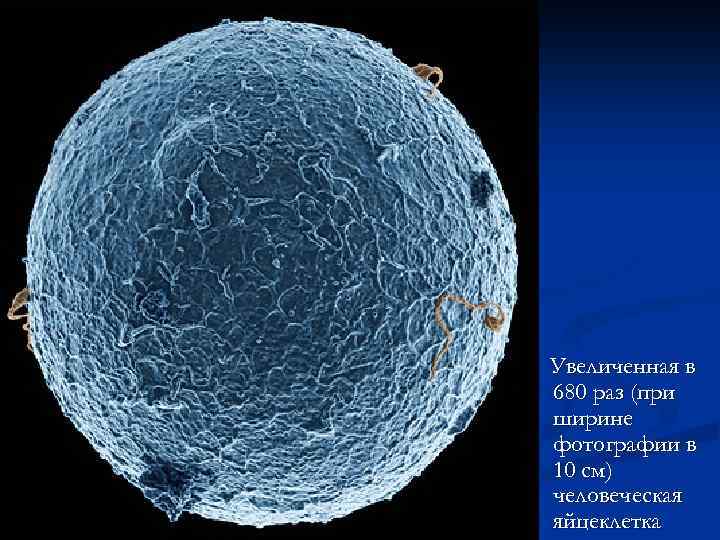 Увеличенная в 680 раз (при ширине фотографии в 10 см) человеческая яйцеклетка 
