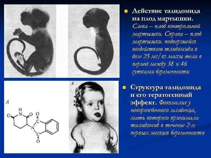 n n Действие талидомида на плод мартышки. Слева – плод контрольной мартышки. Справа –