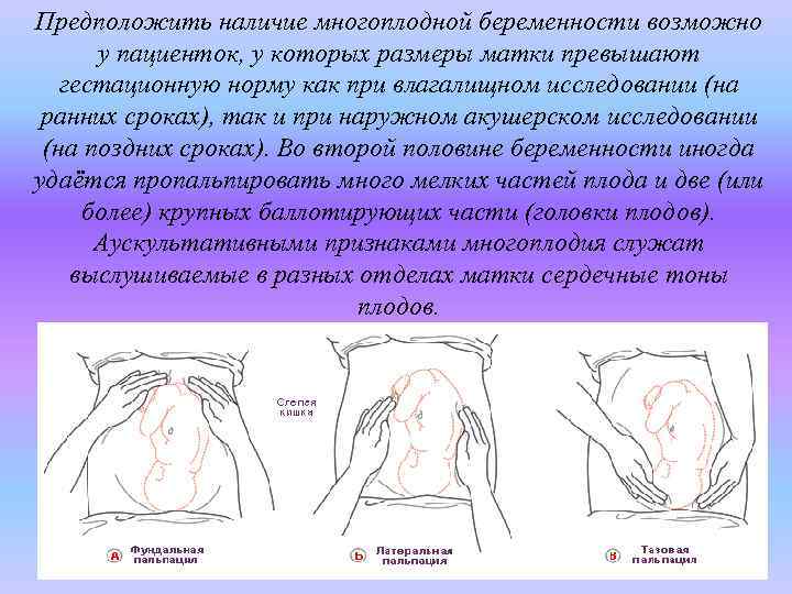 Предположить наличие многоплодной беременности возможно у пациенток, у которых размеры матки превышают гестационную норму