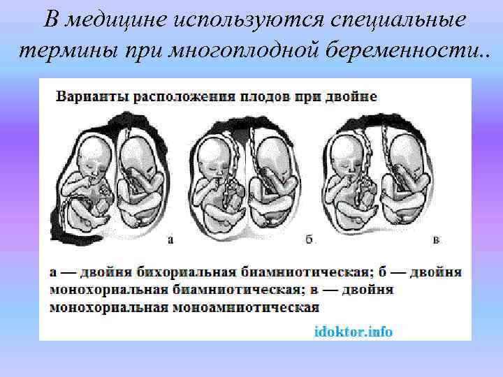 План ведения беременности при многоплодной беременности