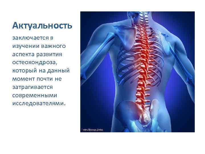Актуальность заключается в изучении важного аспекта развития остеохондроза, который на данный момент почти не