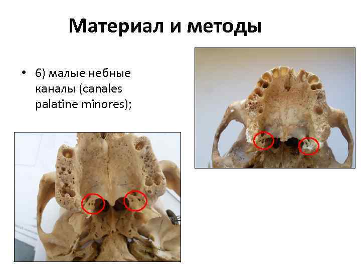 Материал и методы • 6) малые небные каналы (canales palatine minores); 