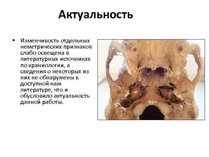 Актуальность • Изменчивость отдельных неметрических признаков слабо освещена в литературных источниках по краниологии, а
