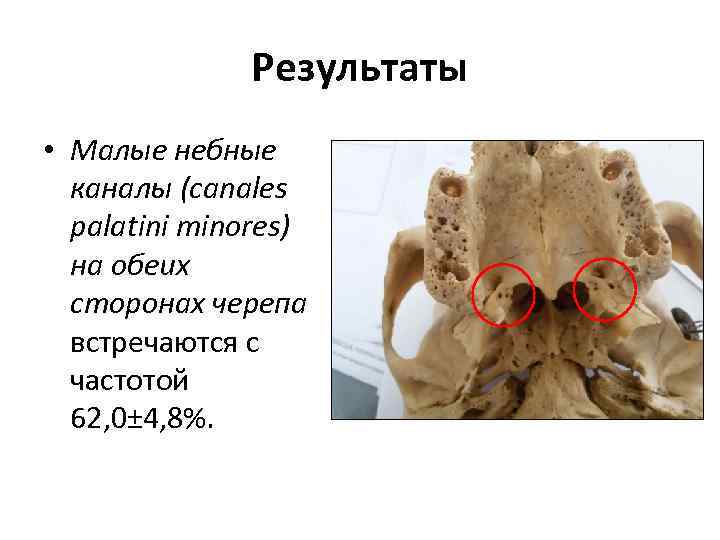 Мало результатов