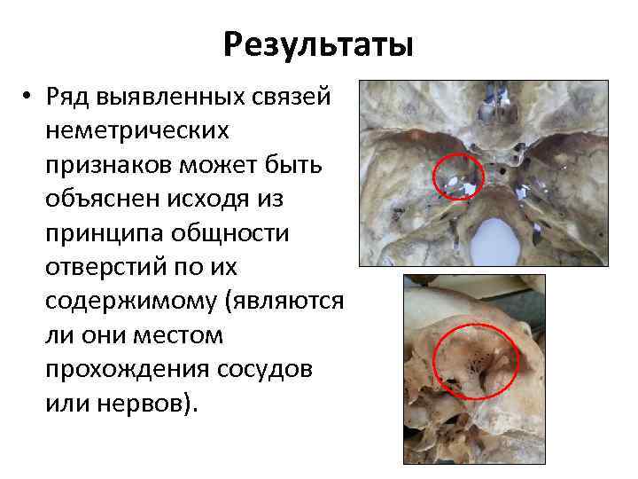 Результаты • Ряд выявленных связей неметрических признаков может быть объяснен исходя из принципа общности