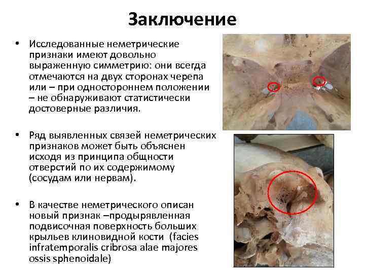 Заключение • Исследованные неметрические признаки имеют довольно выраженную симметрию: они всегда отмечаются на двух