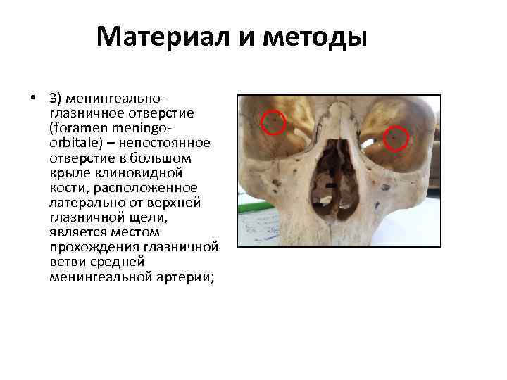 Материал и методы • 3) менингеальноглазничное отверстие (foramen meningoorbitale) – непостоянное отверстие в большом