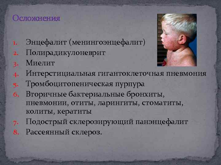 Осложнения Энцефалит (менингоэнцефалит) Полирадикулоневрит Миелит Интерстициальная гигантоклеточная пневмония Тромбоцитопеническая пурпура Вторичные бактериальные бронхиты, пневмонии,