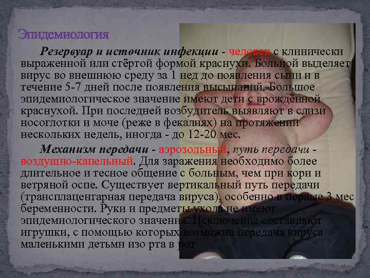 Эпидемиология Резервуар и источник инфекции - человек с клинически выраженной или стёртой формой краснухи.
