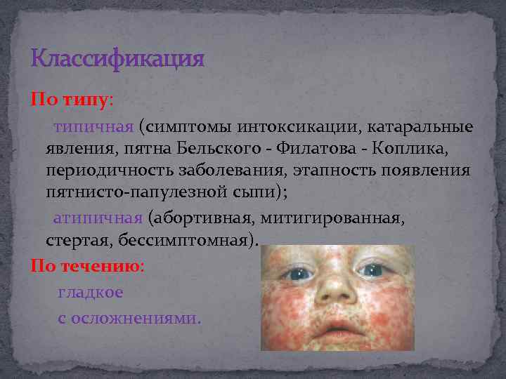 Классификация По типу: типичная (симптомы интоксикации, катаральные явления, пятна Бельского - Филатова - Коплика,