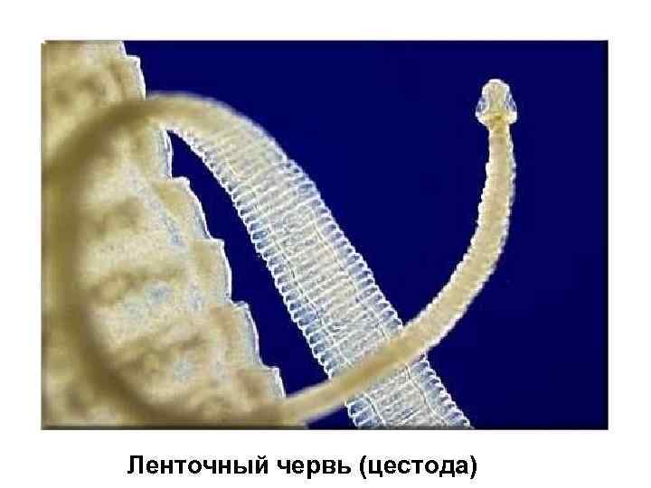Ленточный червь (цестода) 