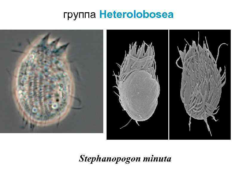 группа Heterolobosea Stephanopogon minuta 