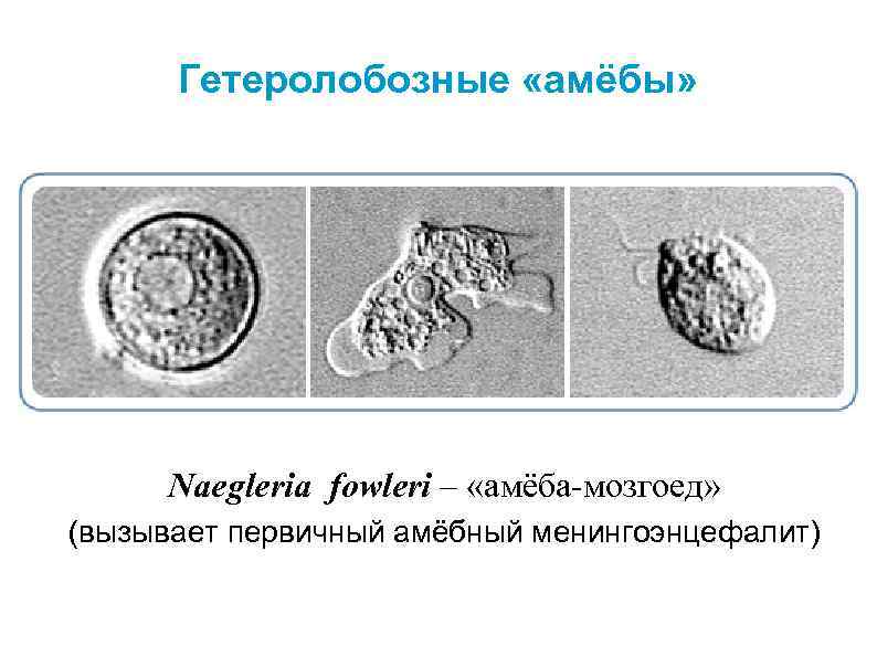 Гетеролобозные «амёбы» Naegleria fowleri – «амёба-мозгоед» (вызывает первичный амёбный менингоэнцефалит) 