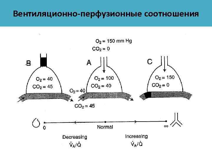 Вентиляционно-перфузионные соотношения 