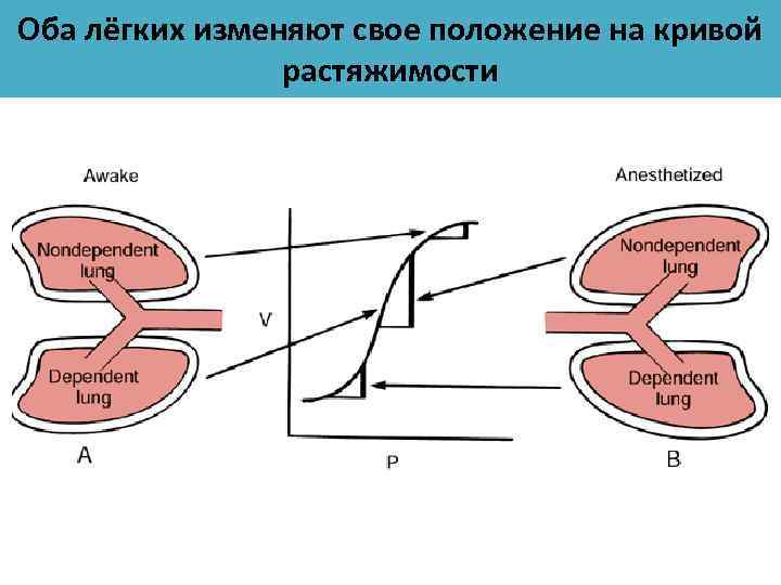 Оба лёгких изменяют свое положение на кривой растяжимости 