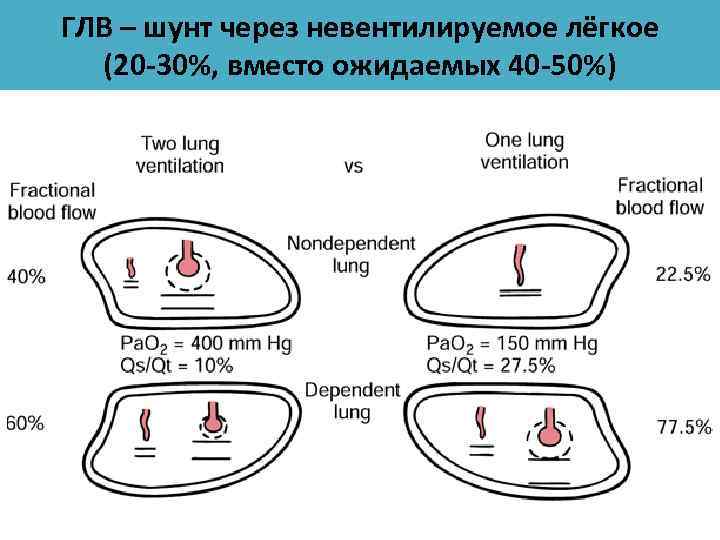 ГЛВ – шунт через невентилируемое лёгкое (20 -30%, вместо ожидаемых 40 -50%) 