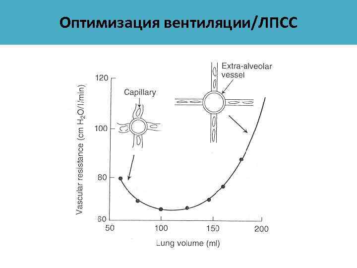 Оптимизация вентиляции/ЛПСС 
