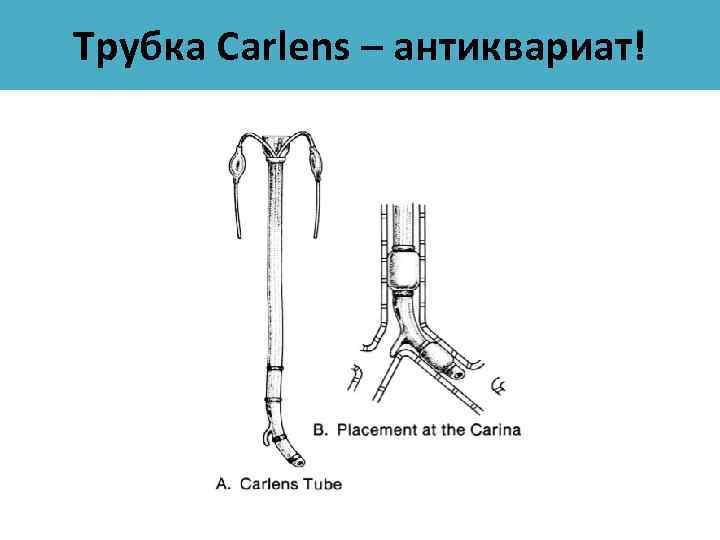 Трубка Carlens – антиквариат! 