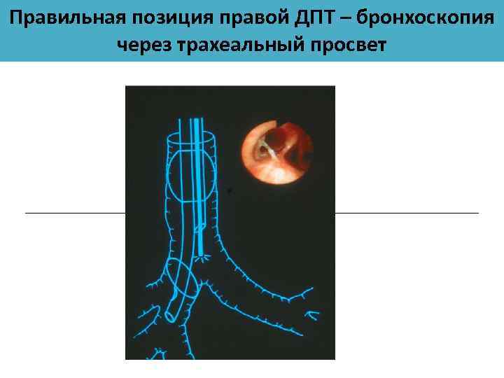 Правая позиция