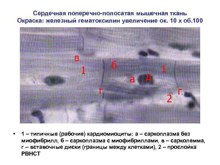 Сердечная поперечно-полосатая мышечная ткань Окраска: железный гематоксилин увеличение ок. 10 х об. 100 •
