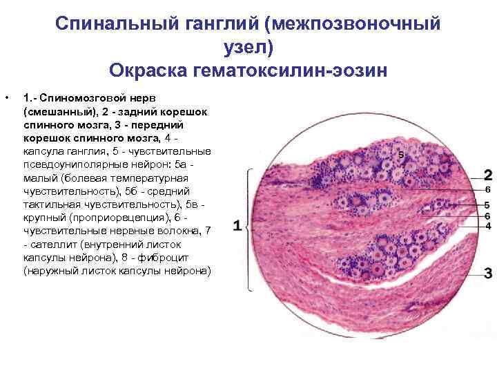 Спинальный ганглий (межпозвоночный узел) Окраска гематоксилин-эозин • 1. - Спиномозговой нерв (смешанный), 2 -