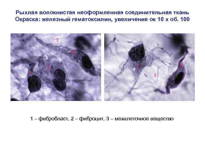 Рыхлая волокнистая неоформленная соединительная ткань Окраска: железный гематоксилин, увеличение ок 10 х об. 100