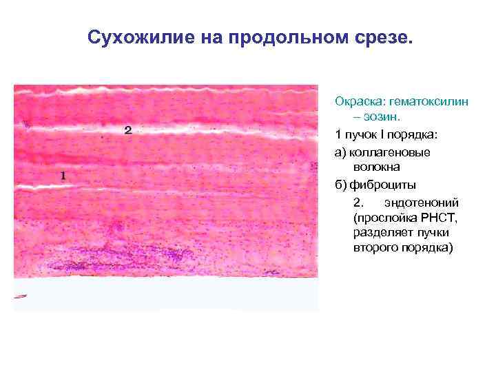 Сухожилие на продольном срезе. Окраска: гематоксилин – эозин. 1 пучок I порядка: а) коллагеновые