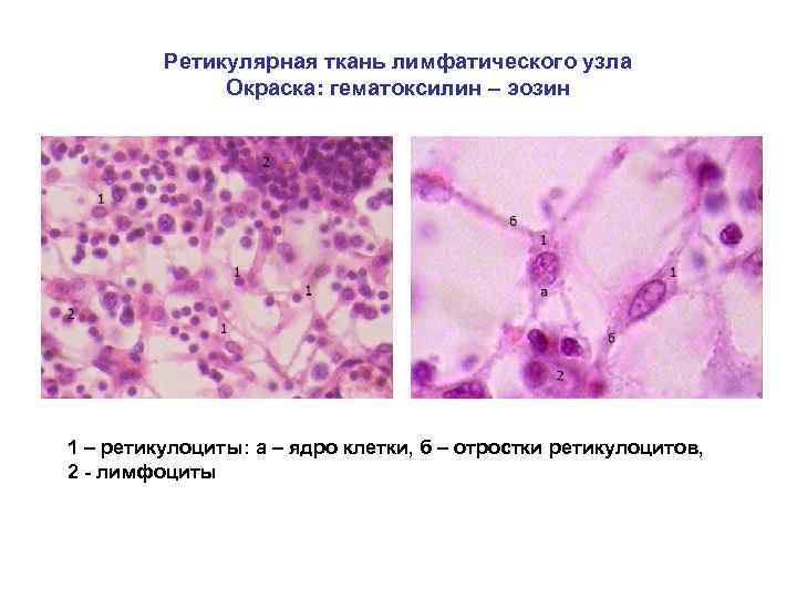 Ретикулярная ткань лимфатического узла Окраска: гематоксилин – эозин 1 – ретикулоциты: а – ядро