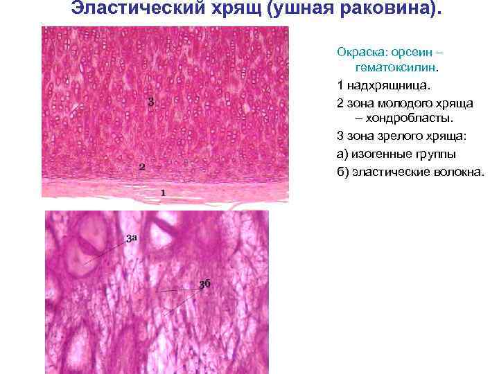 Эластический хрящ (ушная раковина). Окраска: орсеин – гематоксилин. 1 надхрящница. 2 зона молодого хряща