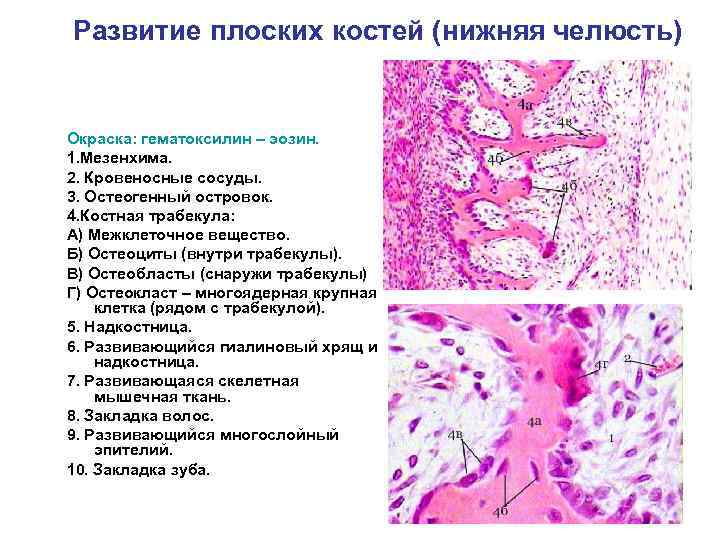 Развитие плоских костей (нижняя челюсть) Окраска: гематоксилин – эозин. 1. Мезенхима. 2. Кровеносные сосуды.