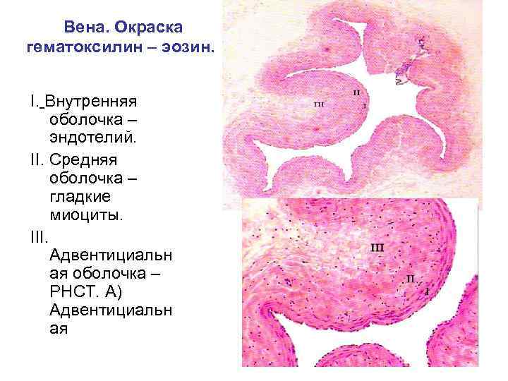 Вена. Окраска гематоксилин – эозин. I. Внутренняя оболочка – эндотелий. II. Средняя оболочка –