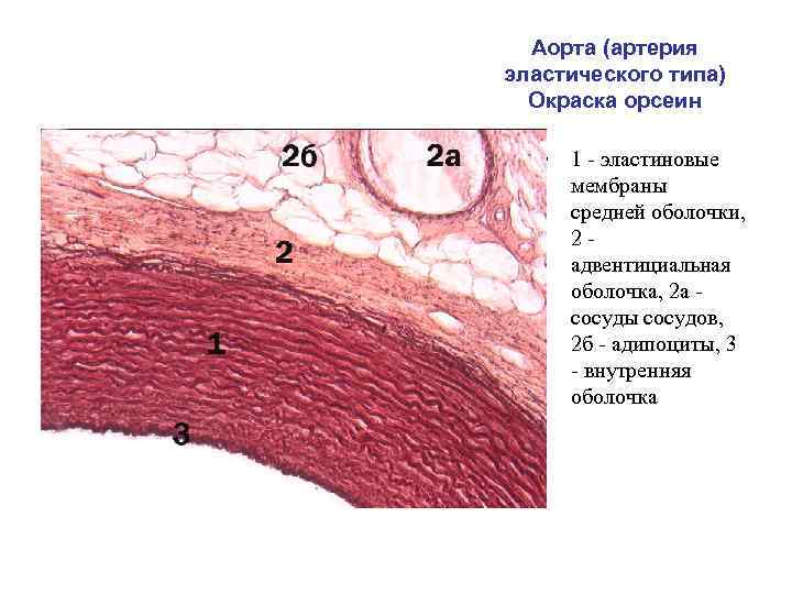 Аорта (артерия эластического типа) Окраска орсеин • 1 - эластиновые мембраны средней оболочки, 2