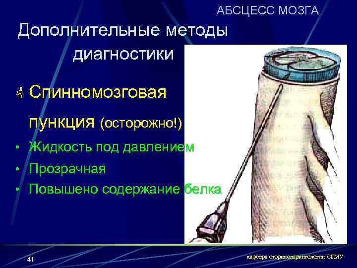 АБСЦЕСС МОЗГА Дополнительные методы диагностики G Спинномозговая пункция (осторожно!) • Жидкость под давлением •