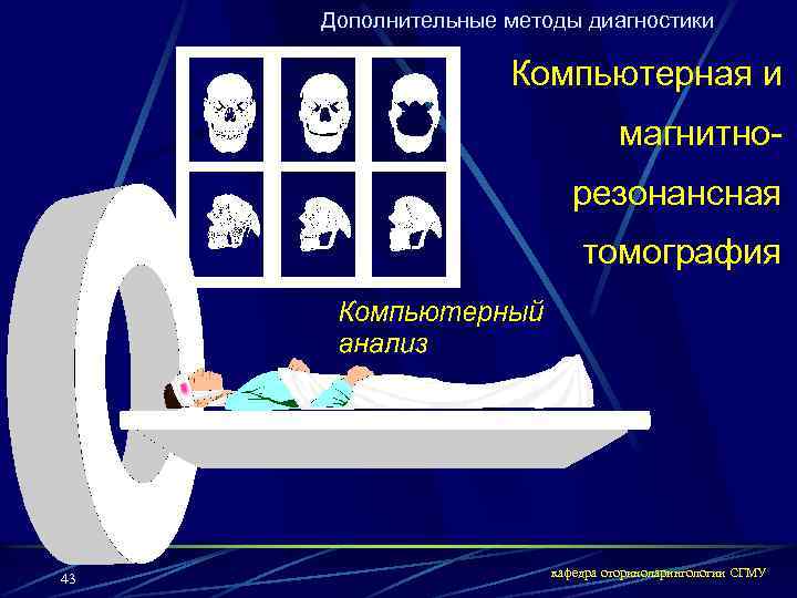 Дополнительные методы диагностики Компьютерная и магнитнорезонансная томография 43 кафедра оториноларингологии СГМУ 