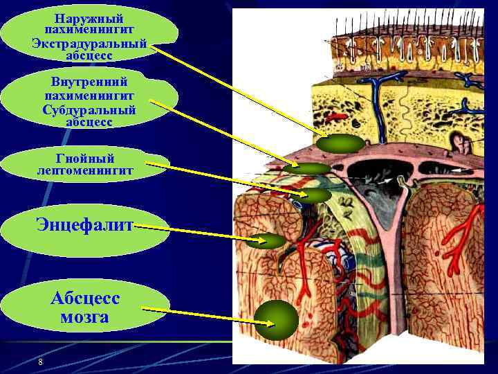 Наружный пахименингит Экстрадуральный абсцесс Внутренний пахименингит Субдуральный абсцесс Гнойный лептоменингит Энцефалит Абсцесс мозга 8