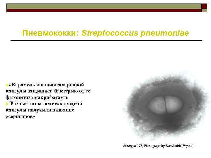 Пневмококки: Streptococcus pneumoniae ■ «Карамелька» полисахаридной капсулы защищает бактерию от ее фагоцитоза макрофагами ■