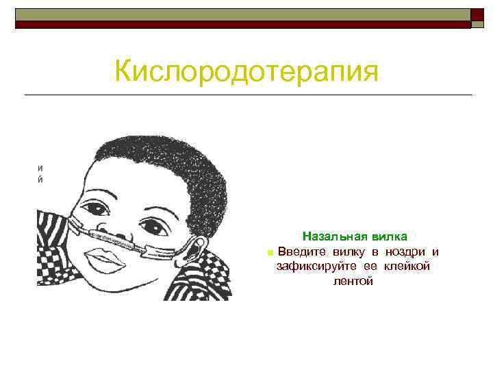 Кислородотерапия Назальная вилка ■ Введите вилку в ноздри и зафиксируйте ее клейкой лентой 