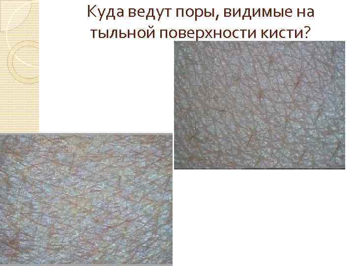 Куда ведут поры, видимые на тыльной поверхности кисти? 