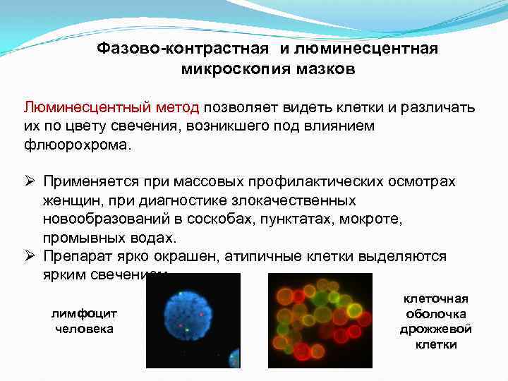 Фазово-контрастная и люминесцентная микроскопия мазков Люминесцентный метод позволяет видеть клетки и различать их по