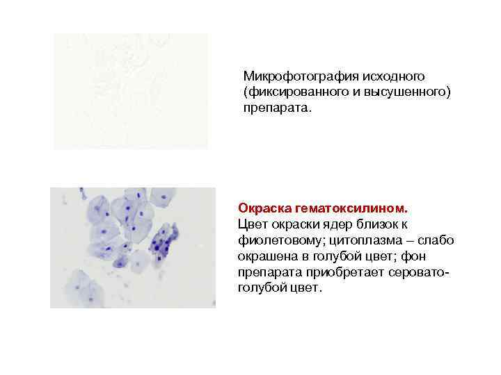 Микрофотография исходного (фиксированного и высушенного) препарата. Окраска гематоксилином. Цвет окраски ядер близок к фиолетовому;