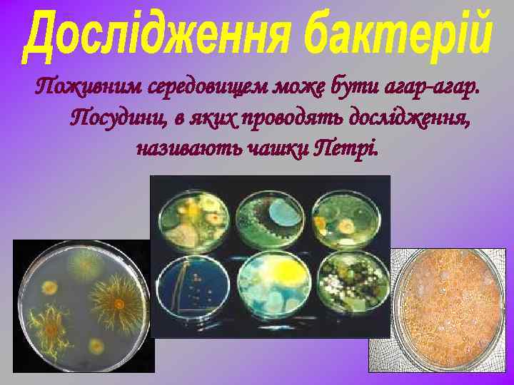 Поживним середовищем може бути агар-агар. Посудини, в яких проводять дослідження, називають чашки Петрі. 