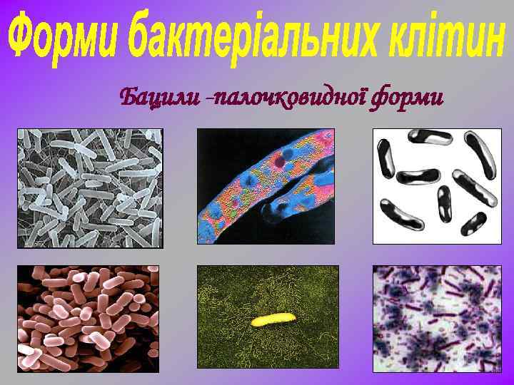 Бацили -палочковидної форми 