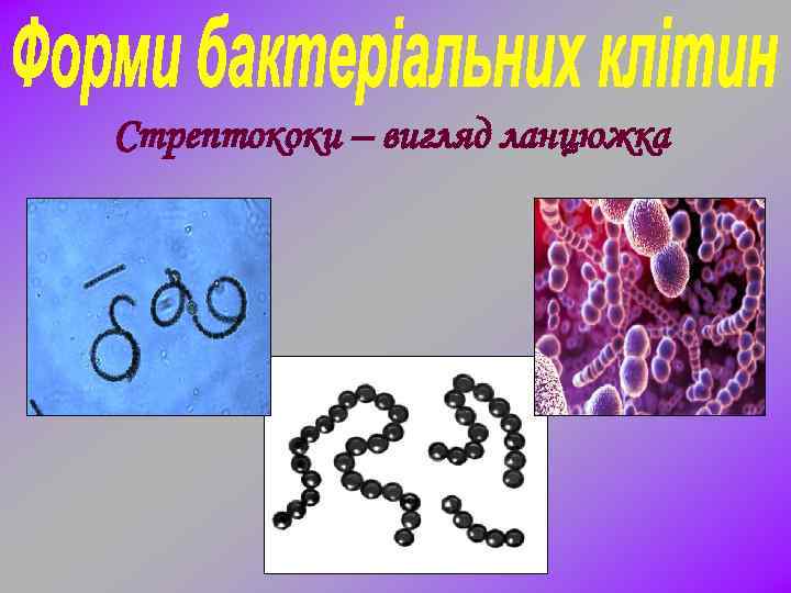 Стрептококи – вигляд ланцюжка 
