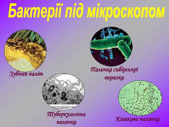 Паличка сибірської виразки Зубний наліт Туберкульозна паличка Кишкова паличка 