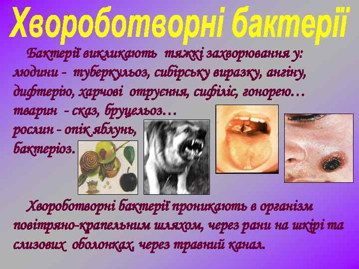 Бактерії викликають тяжкі захворювання у: людини - туберкульоз, сибірську виразку, ангіну, дифтерію, харчові отруєння,
