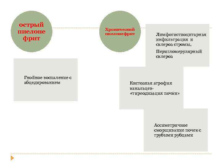 острый пиелоне фрит Гнойное воспаление с абцедированием Хронический пиелонефрит Лимфогистиоцитарная инфильтрация и склероз стромы,