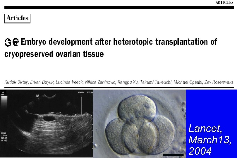 Lancet, March 13, 2004 
