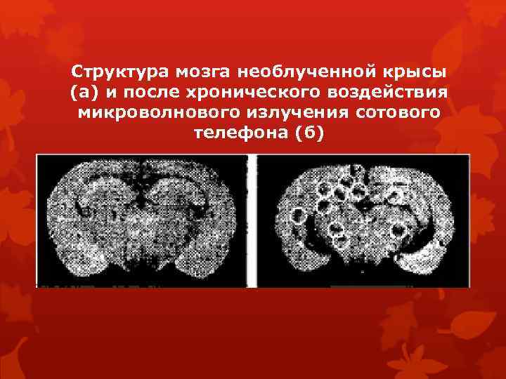 Структура мозга необлученной крысы (а) и после хронического воздействия микроволнового излучения сотового телефона (б)