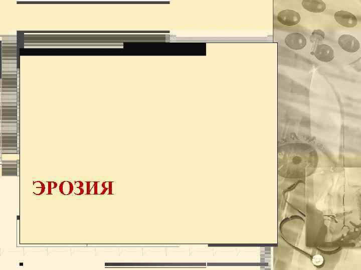 ЭРОЗИЯ 