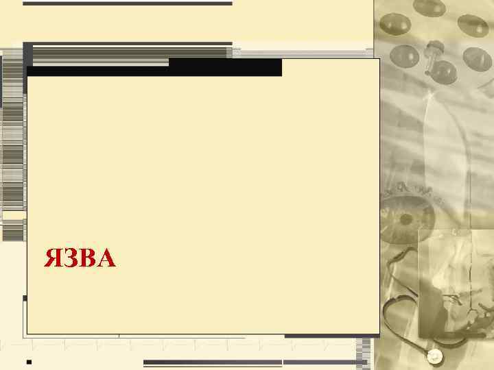 ЯЗВА 